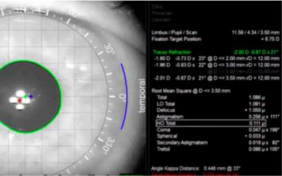 Kąt alfa i niespodzianki refrakcyjne
